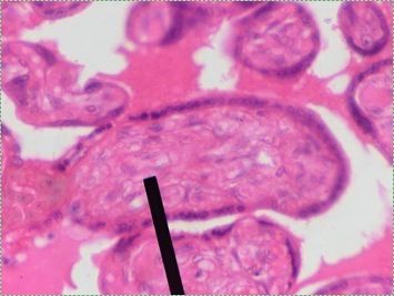 histology of mesenchyme