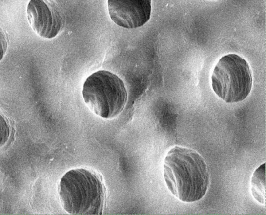 electron micrograph of dentinal tubules