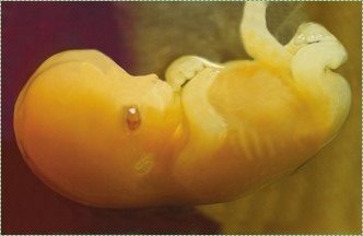scientific photo of a human embryo
