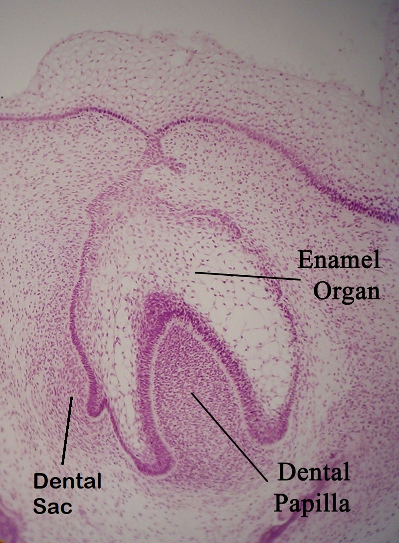 histology of tooth bud
