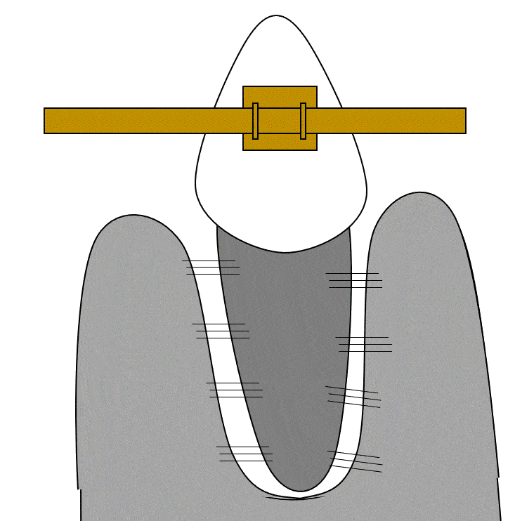 animation of orthodontia