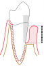 Periodontium Development – Histology And Embryology For Dental Hygiene