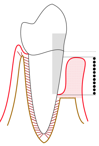 illustration of a tooth