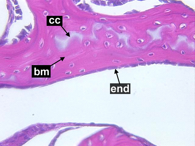 histology of spongy bone