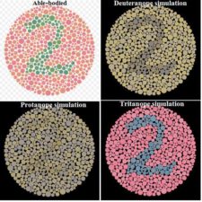 Hemophilia: a sex-linked disorder