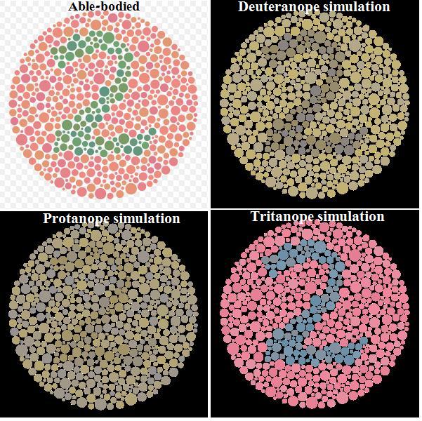 Hemophilia A Sex Linked Disorder Mt Hood Community College Biology 102