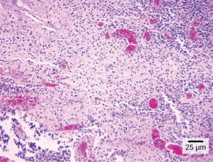 figure_03_03a-1 salmonella bacteria