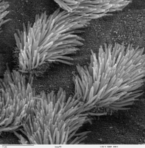 lung cilia look like bristles sticking up from a surface in clumps.