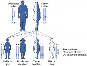 Hemophilia: a sex-linked disorder – Principles of Biology