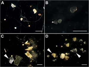 Microscope images show tiny reflective plastic particles in imaged samples.