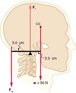 A head and neck system as a lever. The force at the joint acts upward on the head, the force of the neck muscles acts on the back of the head 5 cm behind the joint. The weight of the head acts downward on the front of the head 2.5 cm in front of the joint.