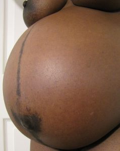 presentation pregnancy and birth