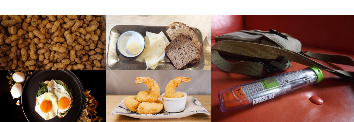 A collage of photos shows common food allergens (peanuts, a tray of bread and cheese, fried eggs, and fried shrimp), plus a photo of an EpiPen next to a purse.