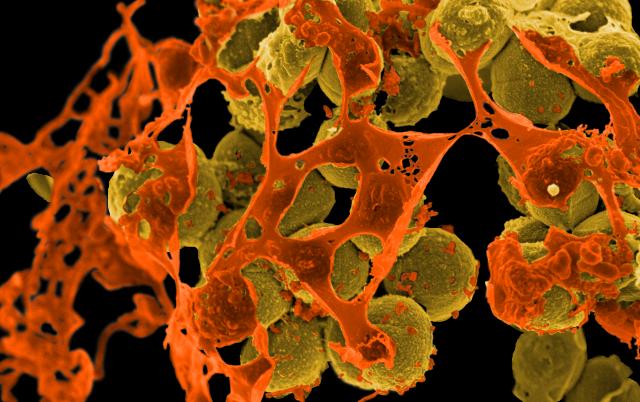 The image shows a scanning electron micrograph of MRSA, appearing at yellow globules against a black background, with orange debris around them.
