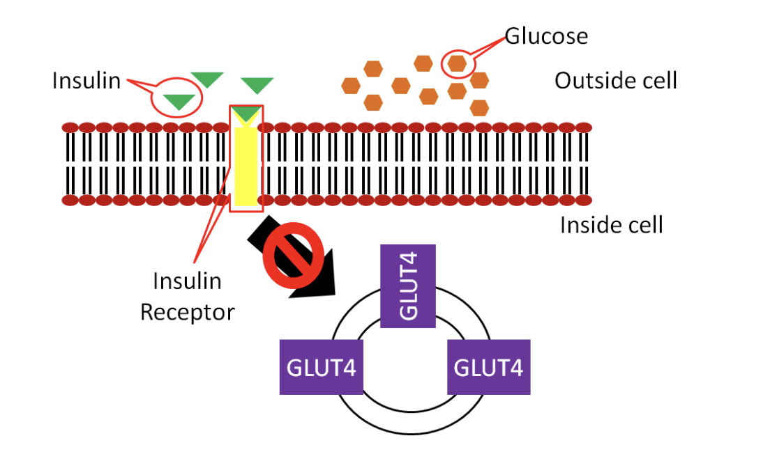 Schematic showing that in type 2 diabetes, the cell does not respond appropriately to insulin, so glucose is stuck outside the cell.