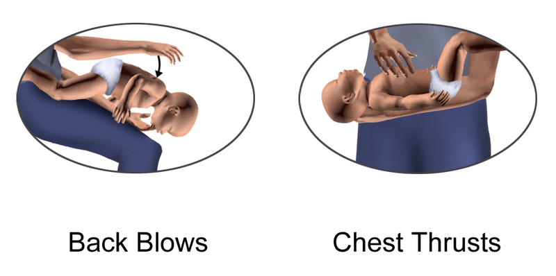 A pair of images. One shows a baby facedown on an adult's lap, the adult is administering open-handed downward blows onto the baby's back. In the other, the baby is face up being held in the crook of an adult's arm, and compressions are being applied to the baby's chest.