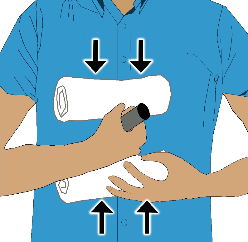 A graphic of impaled object in anterior chest wall, object being held in place while bulking dressing is being placed/moved into place to secure object