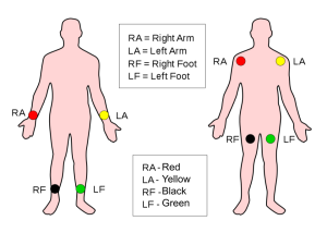 Diagrams of placement for right arm, left arm, right food and left foot. Two diagrams are shown with alternate placement options - shoulder or wrist, foot or RLQ/LLQ of abdomen.
