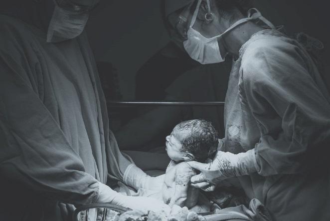 baby being delivered by C-section