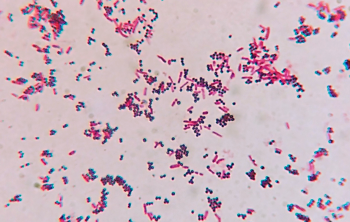 Gram Stain – Microbiology Laboratory Manual