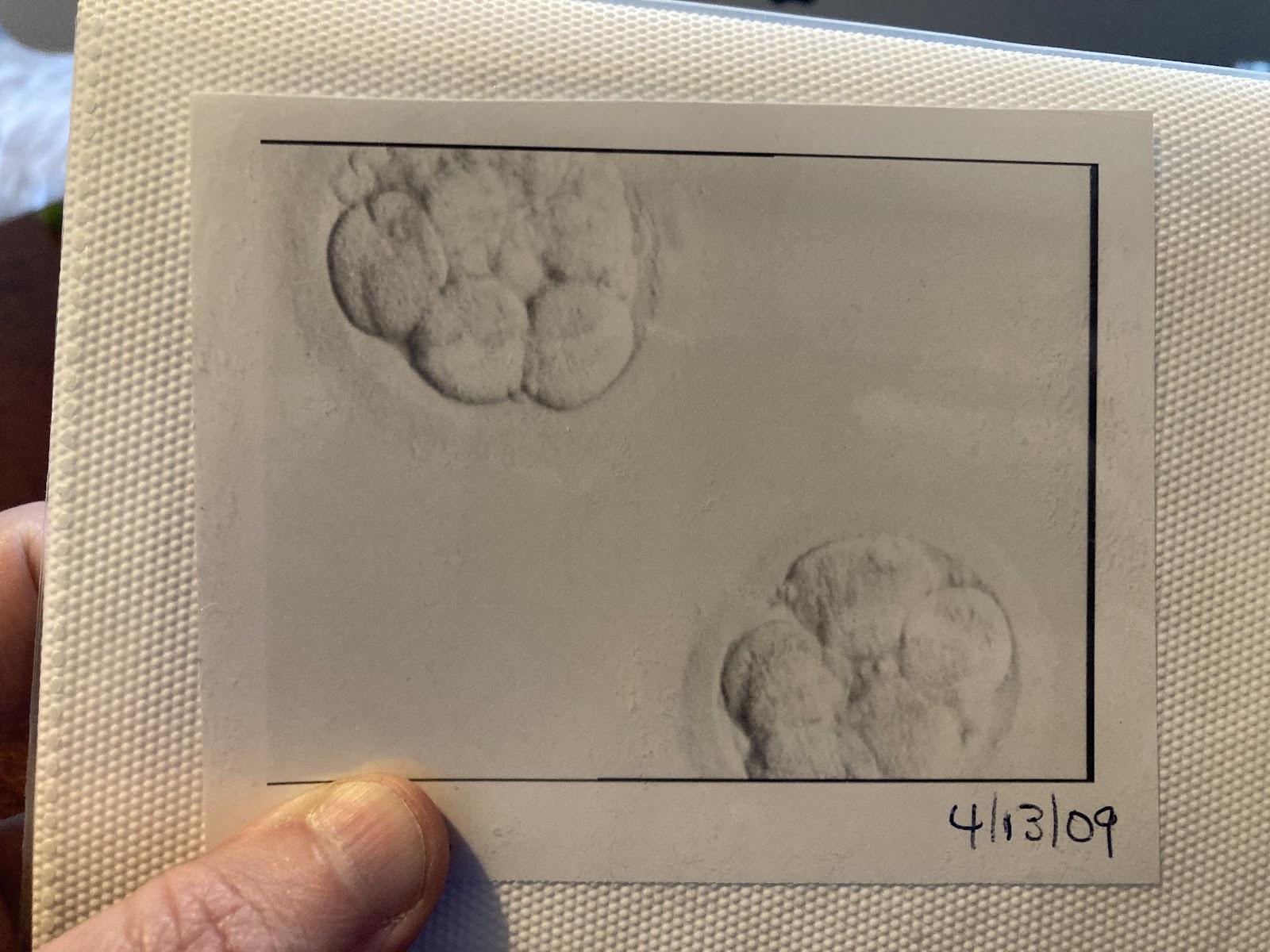 Two embryos in a photo dated 4/13/09