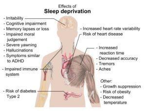 Drawing of the human body pointing out the effects of sleep deprivation.