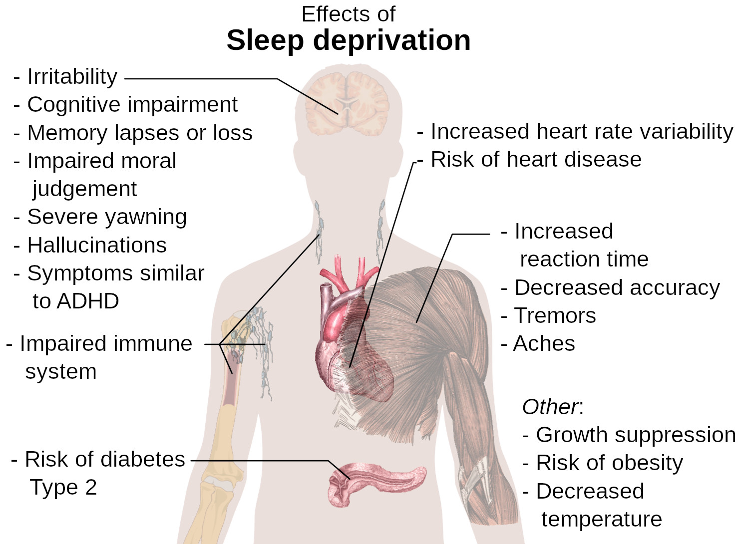 Drawing of the human body pointing out the effects of sleep deprivation.