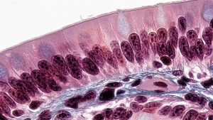 "Epithelial Tissues: Simple Columnar Epithelium" by Bccoer is marked with CC0 1.0 This photomicrograph shows the simple columnar epithelium lining the intestine. We see column-shaped cells with microvilli brush borders to increase surface area for secretion and absorption. The microvilli face the lumen of the tube so that they come into direct contact with foodstuffs.