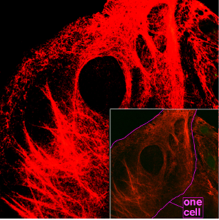 Confocal microscopy of keratin filaments. Fibers appear like red strings being pulled apart