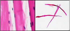 "Smooth Muscle Teased” and “Skeletal Muscle ” by bccoer is marked with CC0 1.0. This photomicrograph shows skeletal muscle tissue in the left panel and smooth muscle tissue teased in the right panel.