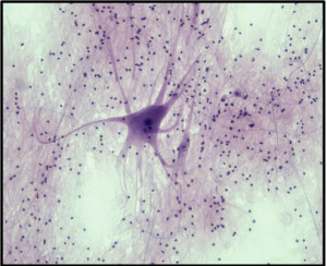 “Nervous Tissue” by bccoer is marked with CC0 1.0. This photomicrograph shows nervous tissue.