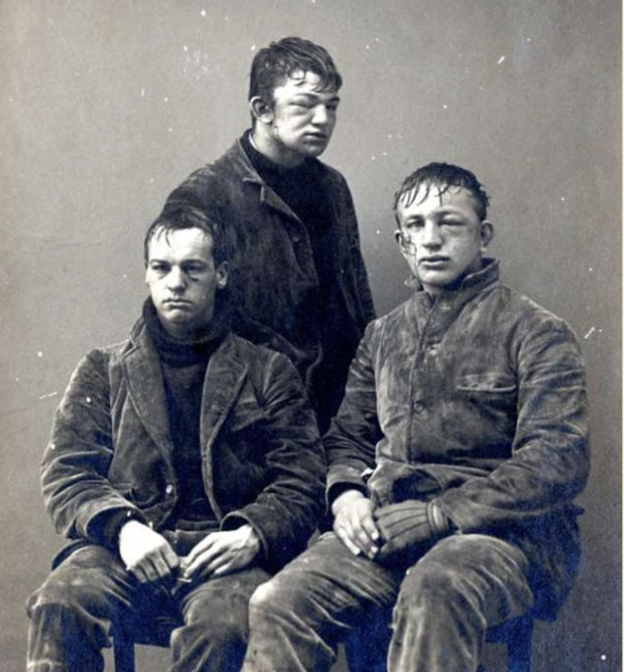 Black and white photo of three young men with bruised faces.