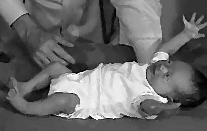 Moro reflex