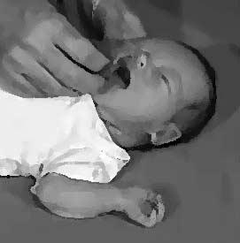Rooting reflex