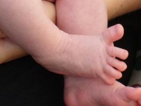 Babinski reflex