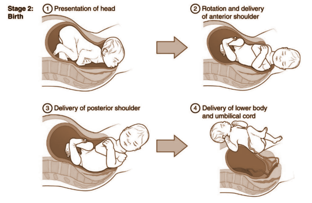 A cross-section view of the four steps of Stage 2: Birth. Image Description Available.