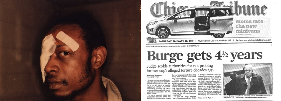 Left: Andrew Wilson with bandages on his facial wounds. Right: A photocopy of the cover of the Chicago Tribune with the headline, "Burge gets 4.5 years."