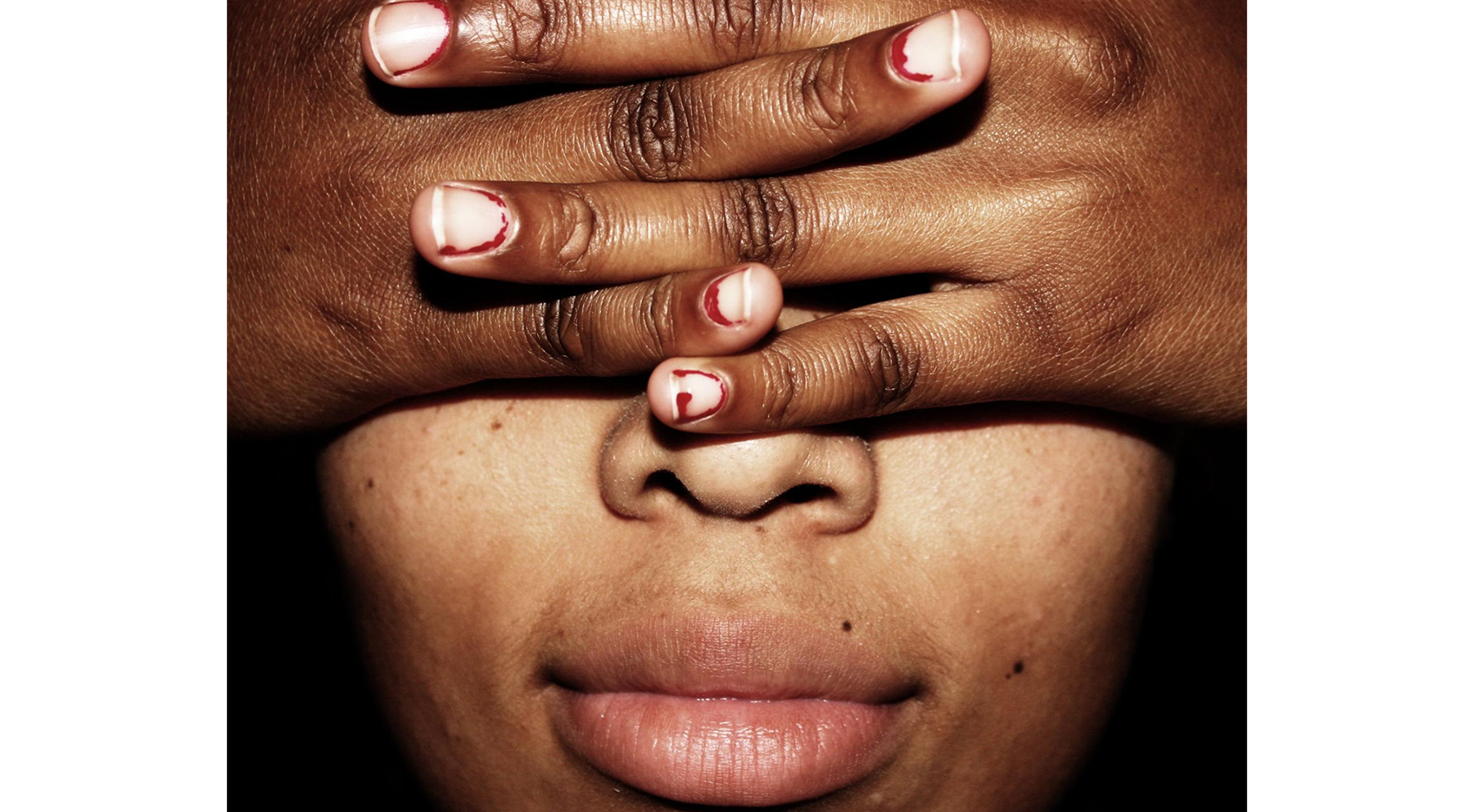A person with dark skin tone covers their eyes with their hands, with a blank facial expression