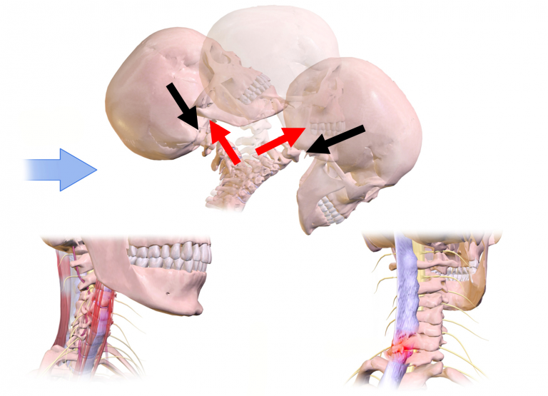 Crowdsource! – Body Physics: Supplementary Material