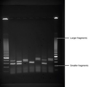 Gel electrophoresis