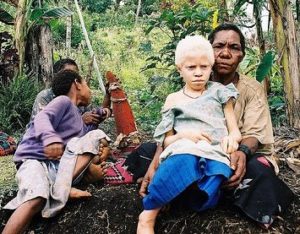 13.Albinistic_girl_papua_new_guinea